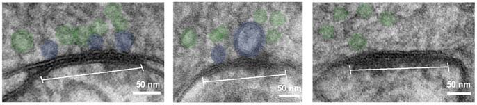 Docked vesicles at a cortical synapse, from brain slices prepared using the "flash and freeze" method. © Carolina Borges Merjane