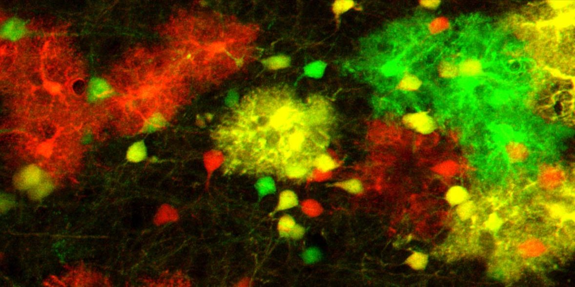 Astrocytes in the mouse brain, labelled using the MADM technique. Credit: Simon Hippenmeyer / IST Austria