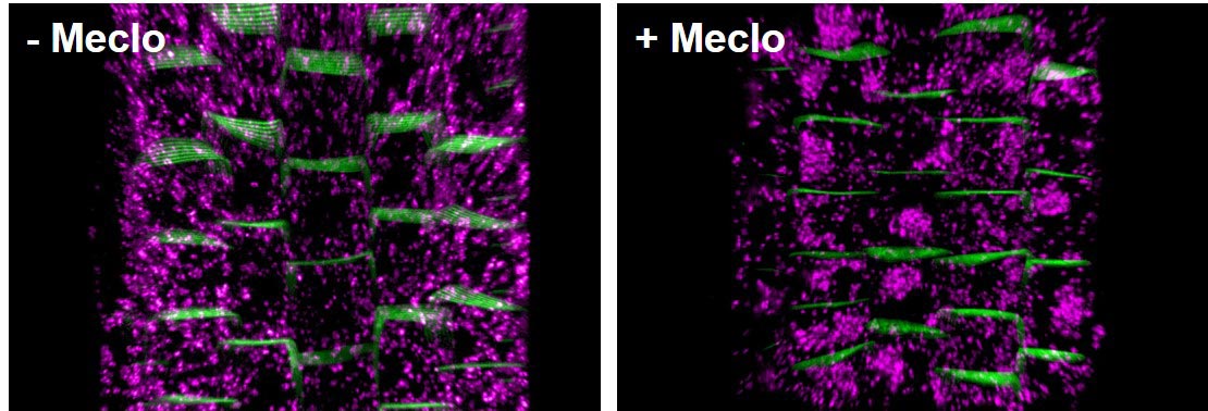 Within 30 minutes, the painkiller Meclo (meclofenamic acid) causes an aggregation of early endosomes – vesicles that form at the plasma membrane – in the root epidermis (magenta). This might explain the effect of NSAIDs on the trafficking of various plasma membrane-resident cargo proteins, including the PIN2 auxin transporter (green). © Shutang Tan / IST Austria