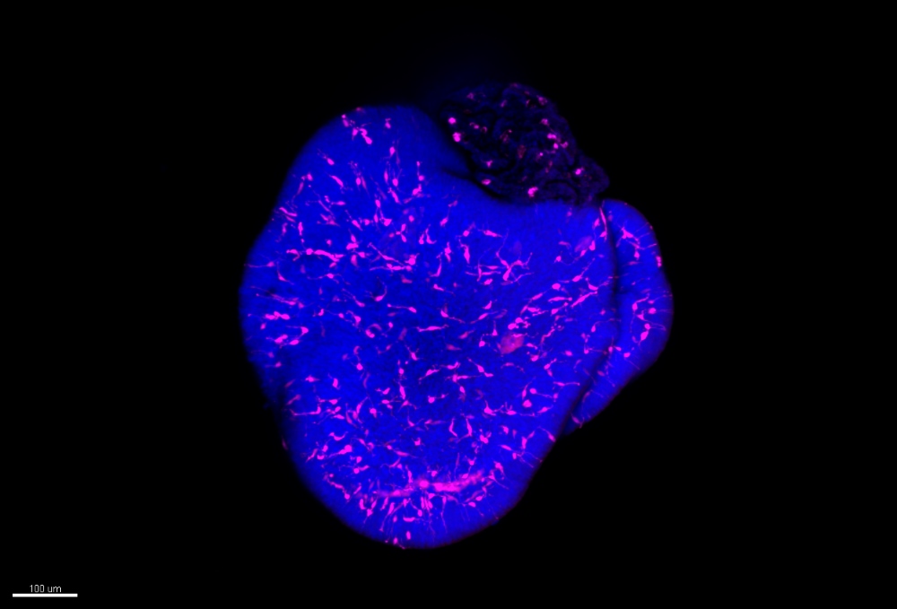 Microglia (magenta) integrated into a retinal organoid. The cell nuclei of neurons are stained in blue.
