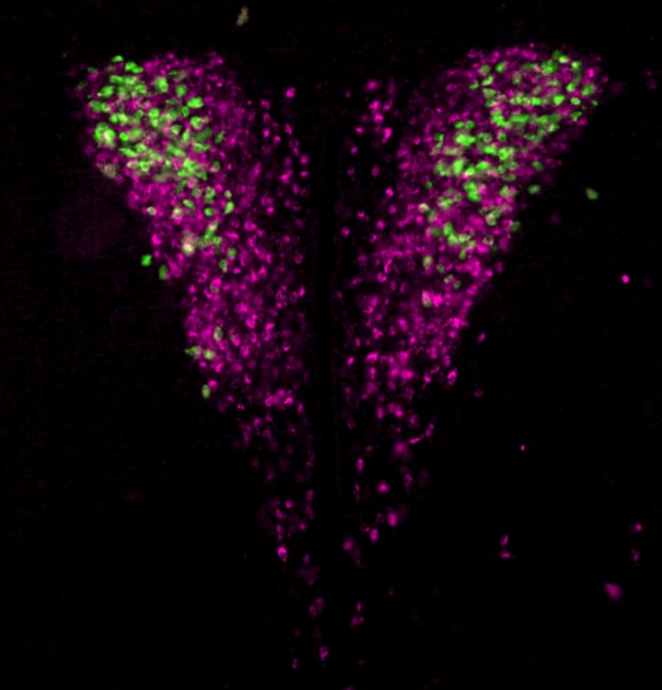 Hypothalamic neurons that control hormone secretion (magenta) and those that specifically control the release of the stress hormone cortisol (green).