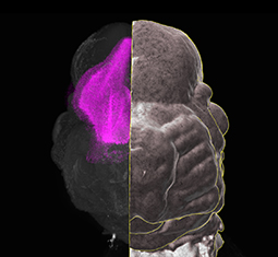 feature image