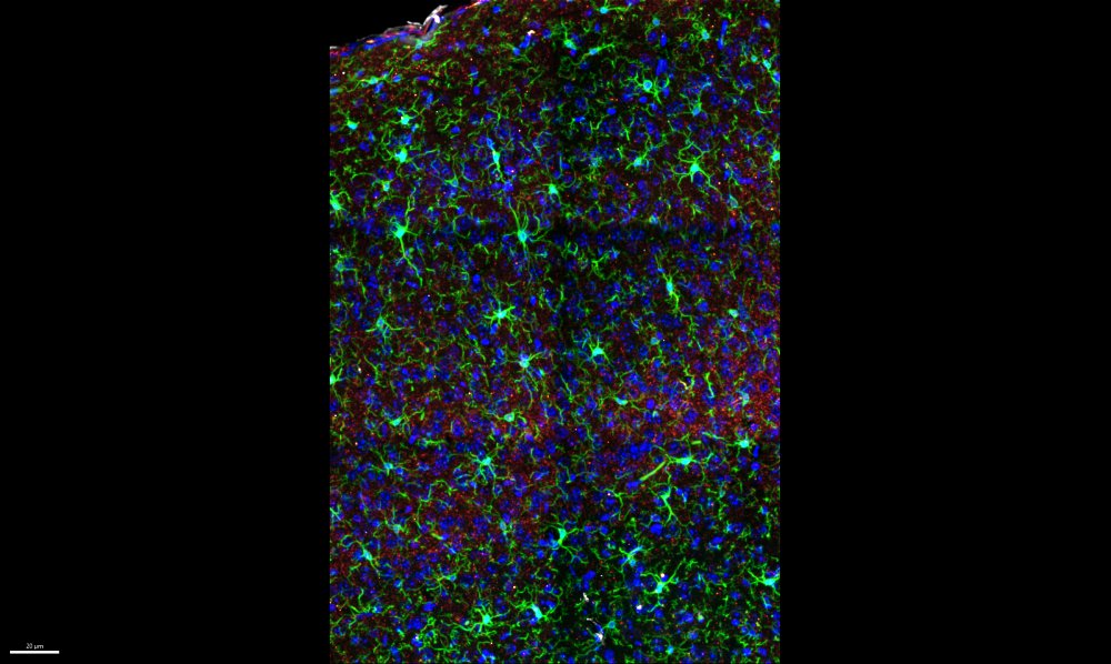 The distribution of microglia across the different cortical layers in the mouse visual cortex.