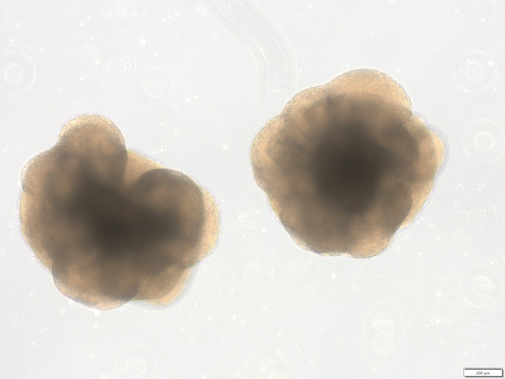Two mouse cortical organoids at 13 days in culture.
